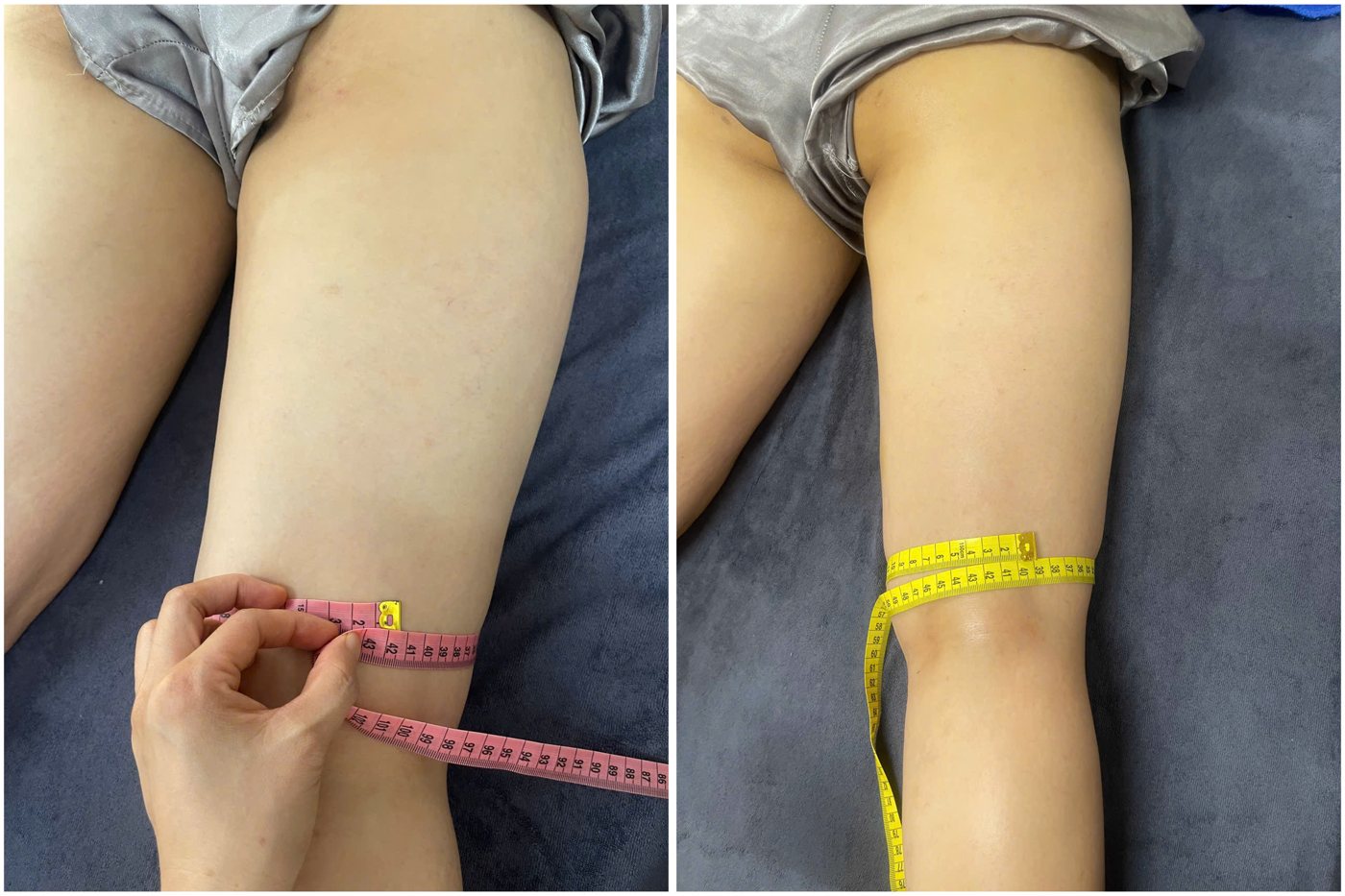 Ca thật giảm mỡ đùi trước và sau liệu trình bấm huyệt tại Mai Liên
